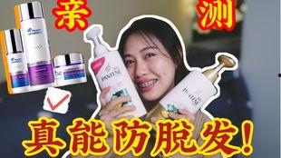 爆料网红掉头发视频下载,揭秘掉发背后的真相与预防方法  第3张